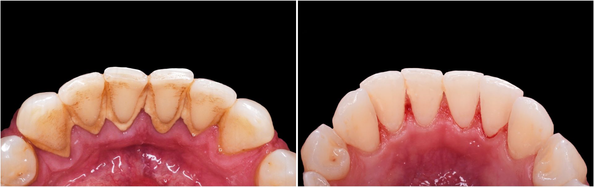 periodontal-services